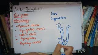 RENAL PATHOLOGY lecture 13b ACUTE PYELONEPHRITIS must watch to get it [upl. by Bottali]