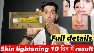 tyrolite cream  Tyrolite cream review  Tyrolite cream uses  Tyrolite cream benefits [upl. by Dutchman]