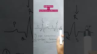 defibrillation vs synchronized cardioversion defibrillationcardioversion [upl. by Rustie]