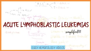 PathologyAcute Lymphoblastic Leukemia Simplified  ALL  All vs AML  acute leukemias [upl. by Alleiram]