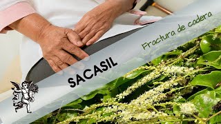 El SACASIL ¿Cómo ayuda en una FRACTURA DE CADERA [upl. by Evin]