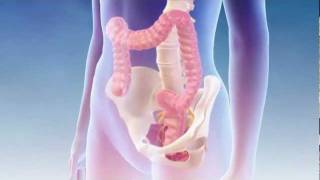 Fecal Incontinence  Interstim Bowel Mechanism of Action [upl. by Dong]