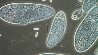 Paramecia Contractile Vacuoles by Edwin Lee [upl. by Adneram]