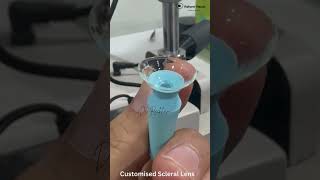 Customized Scleral Lens for keratoconus  Reform Vision  Hyderabad  Eye care  Dr Reekham Lal [upl. by Ettenyl]