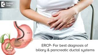 Understanding ERCP Procedure for Pancreas  Blockage Stone amp MoreDr Ravindra BS  Doctors Circle [upl. by Llarret]