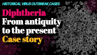 Diphtheria From antiquity to the present Case story 🦠Historical virus outbreak cases [upl. by Ibbetson775]