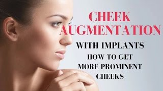 Cheek Augmentation Toronto  Edelstein Cosmetic [upl. by Roban]