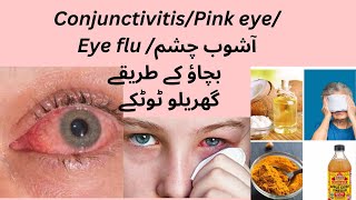 Conjunctivitis Causes symptoms and treatment of conjunctivitis [upl. by Ahsinoj]