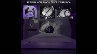 RESONANCIA MAGNETICA CARDIACA  CENTRO MEDICO DIGITAL [upl. by Louanne]