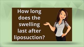 Swelling After Liposuction [upl. by Disini]