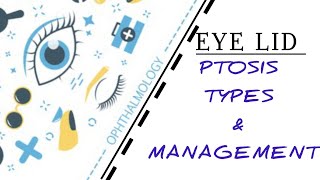 EYELID LECTURE7 PTOSIS TYPES ETIOLOGY TREATMENT [upl. by Edmanda339]