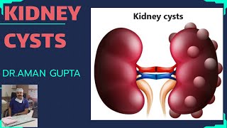 Kidney Cyst Bukol sa Kidney Bosniak Classification ano ang tungkol dito [upl. by Sandell36]