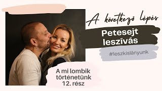 SO2E012  Petesejt leszívás ahogy én éltem meg [upl. by Lymn912]