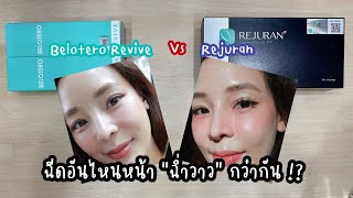 Belotero Revive กับ Rejuran ฉีดอันไหนหน้าฉ่ำวาวกว่ากัน [upl. by Chiquia]