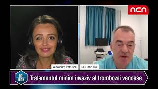 Tromboza venoasa profunda  tratament rapid si minim invaziv  dr Florin Bloj [upl. by Tnaryb785]