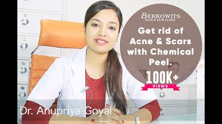 Chemical Peel for Acne Scar and Microneedling Skin Peeling Treatment [upl. by Madeline615]