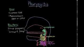 Pharyngitis [upl. by Ardnosal]