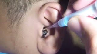 Massive Earwax Removal in One Piece The Best Technique [upl. by Droffats433]