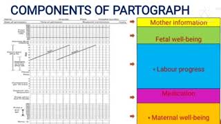 PARTOGRAPH Plotting in Malayalam [upl. by Annahavas]