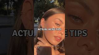 6 Actual Acne Tips viralshorts acnetreatment acnescars [upl. by Herrah763]