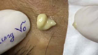 Satisfying video with Chung Vo Spa 137 [upl. by Dolorita]