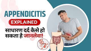 Appendicitis in Hindi  Causes Karan Symptoms Tests Lecture amp Treatment  Appendix Kya Hota Hai [upl. by Dat393]