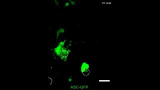 Le mécanisme d’un candidat vaccin antisida filmé in vivo [upl. by Ahsilla]