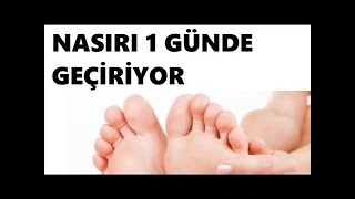 Muz Kabuğu ile Nasır Temizliği Rahatlatıcı Video [upl. by Nichola386]