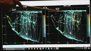 Scatter Plots and Histograms in MegaLogViewer HD [upl. by Rowen728]