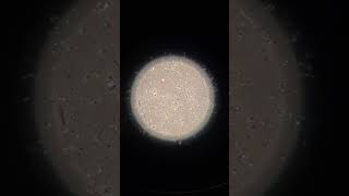 Inside the Lab Sperm Under the Microscope EmbryologyInsights [upl. by Cleland626]