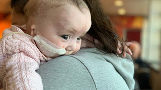 Living With Trisomy 13  Darcie Crofton Full Trisomy 13 [upl. by Nnyleak664]