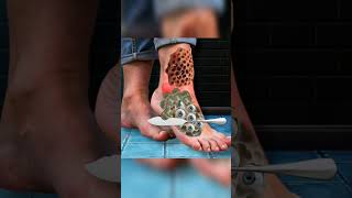 Asmr Treatment Foot  asmr asmranimation short viral satisfying relax 2danimation [upl. by Tamara]