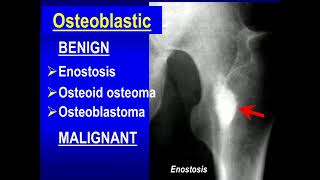 Bone tumour and tumor like lesions [upl. by Salsbury291]