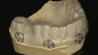 Surgical Guide Scanning Protocol Scan Center [upl. by Hultgren]