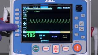 X Series® Advanced Cardioversion English [upl. by Airdnek361]