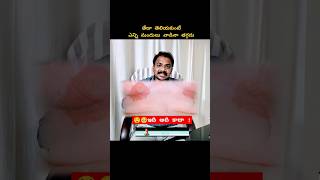 skinallergy doctor healthcaretips drdorababuappana skinallergytreatment [upl. by Hctud]