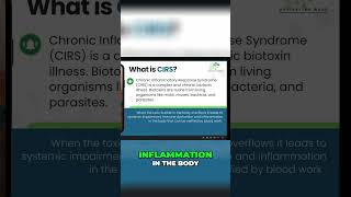 Understanding CIRS Uncovering Chronic Inflammatory Response Syndrome [upl. by Ihcego309]