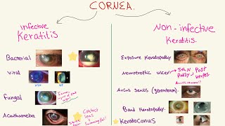 Disorders of the CORNEA  شرح الرمد [upl. by Barbette]