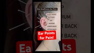 Ear Acupuncture for Back Pain Shorts [upl. by Gorden]