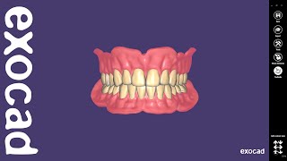 exocad Video Tutorial Full Denture Design [upl. by Surbeck]