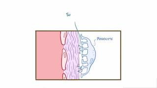 Membranous glomerulonephritis membranous nephropathy causes amp symptoms [upl. by Winou]