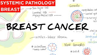 Breast Cancer  Anatomy  causes  classification  Treatment  staging  prognostic amp Risk factors [upl. by Ithnan]