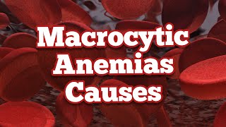 Causes of Macrocytic Anemias  Mnemonic [upl. by Atteloiv]