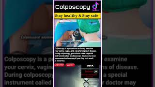 Colposcopy [upl. by Tsugua]