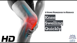 Knee Swelling Begone 8 Effective Home Remedies You Can Try Today [upl. by Rakia504]