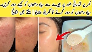 How to Remove Dark Spots from Face Naturally at Home  Home Remedies to Remove Dark Spot [upl. by Ynohtnanhoj]