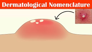 Describing Skin Lesions Dermatological Nomenclature  Macule Papule Pustule Vesicle amp Others [upl. by Naul]