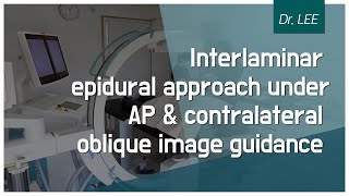 TrailerLearn contralateral oblique Carm image anatomy for lumbar interlaminar epidural block [upl. by Adni]