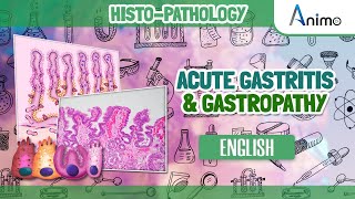 Acute Gastritis amp Gastropathy  Morphology  English [upl. by Marguerita878]