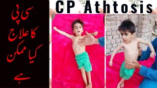 Dyskinetic amp Ataxic cerebral palsy  Movement types in CP  Spastic Quadriplegia Dr Khaqan [upl. by Ardena]